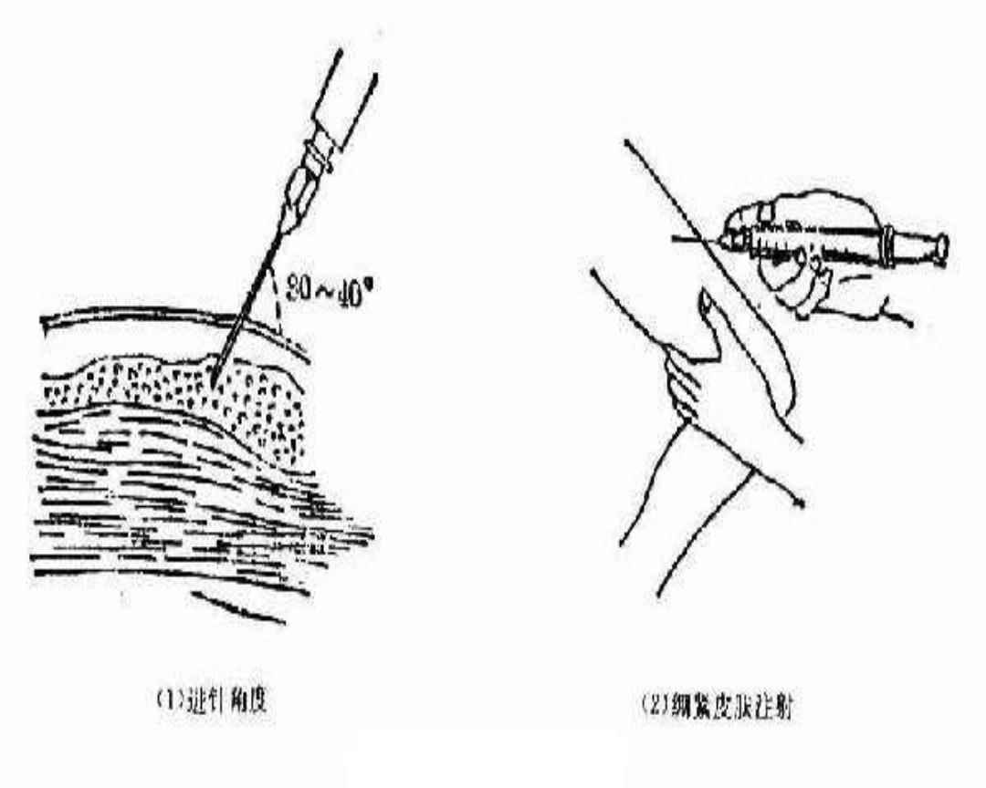 最新肌肉注射教学视频，操作技巧与注意事项